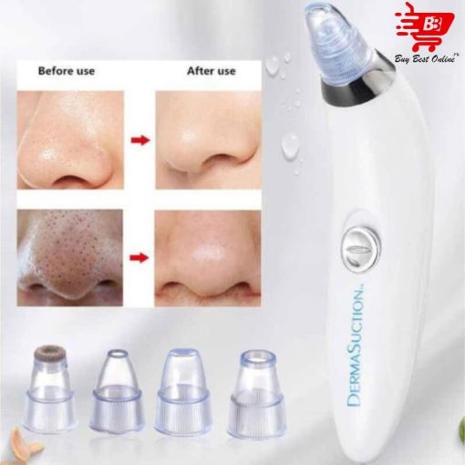 Derma Suction Blackheads Remover 3 In 1 Black Head Remover Machine-acne Pimple Pore Cleaner Vacuum Suction Tool