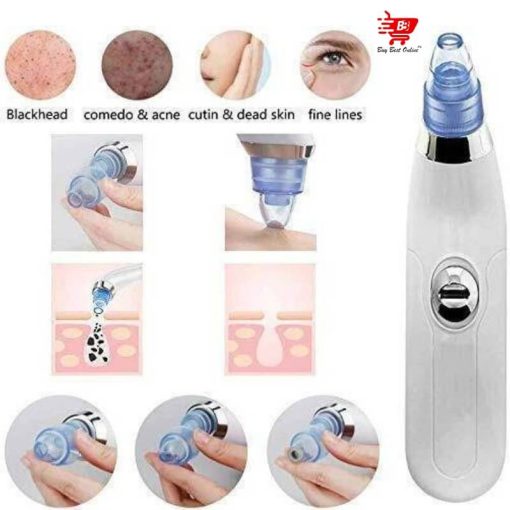 Derma Suction Blackheads Remover 3 In 1 Black Head Remover Machine-acne Pimple Pore Cleaner Vacuum Suction Tool